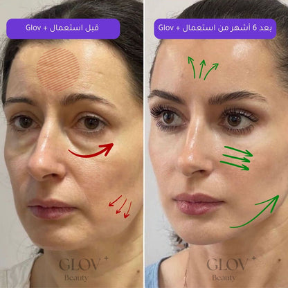 Glov+ | سيروم علاجي بتقنية مايكرو إنفيوجن لتجديد البشرة