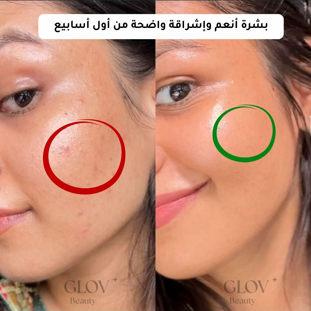 Glov+ | سيروم علاجي بتقنية مايكرو إنفيوجن لتجديد البشرة