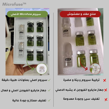 Microfuse™ | علاج طبي مطوّر لتعزيز نمو وكثافة الشعر من الجذور