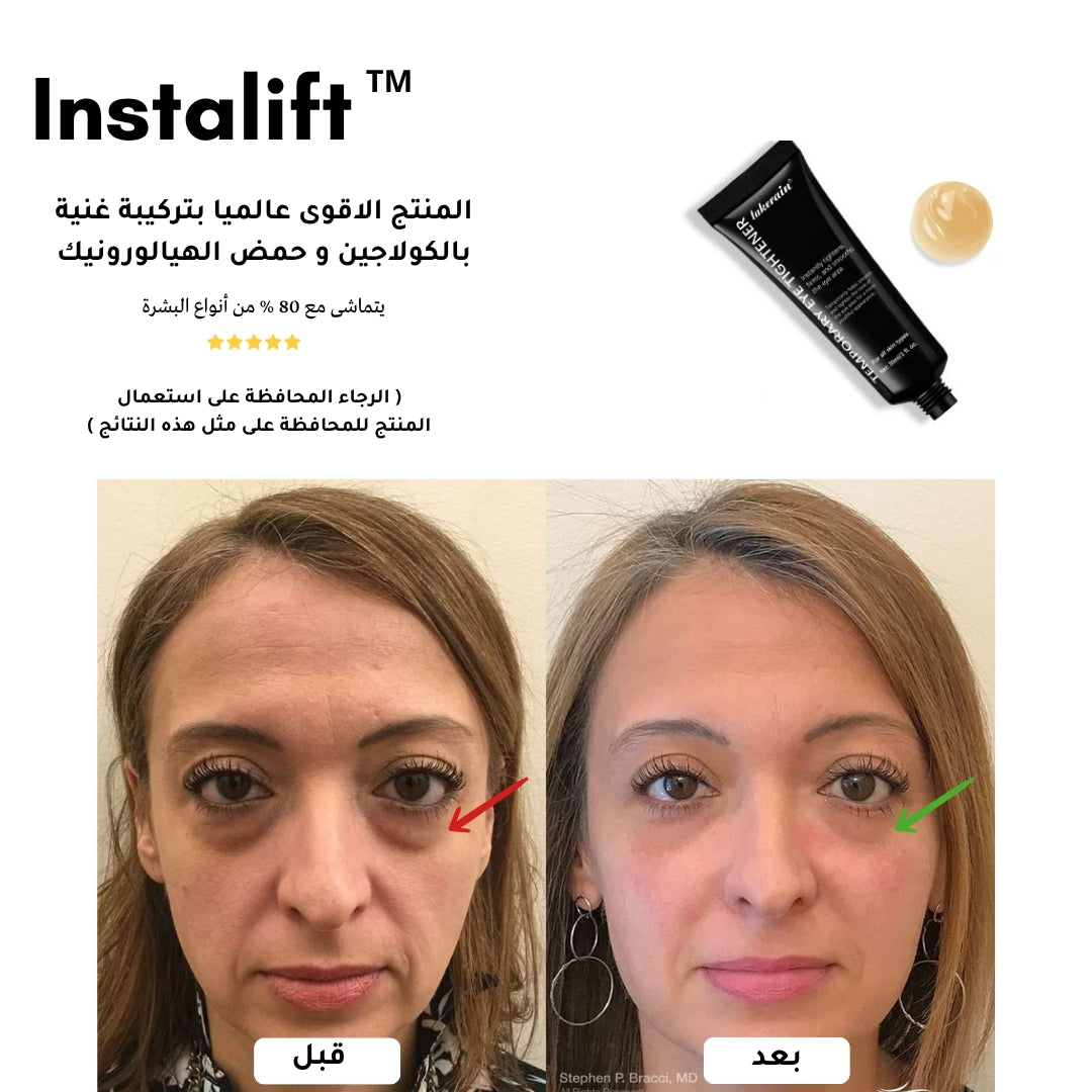 كريم InstaLift™ | إزالة فورية للتجاعيد والانتفاخات حول العين ( + 2 هدايا )